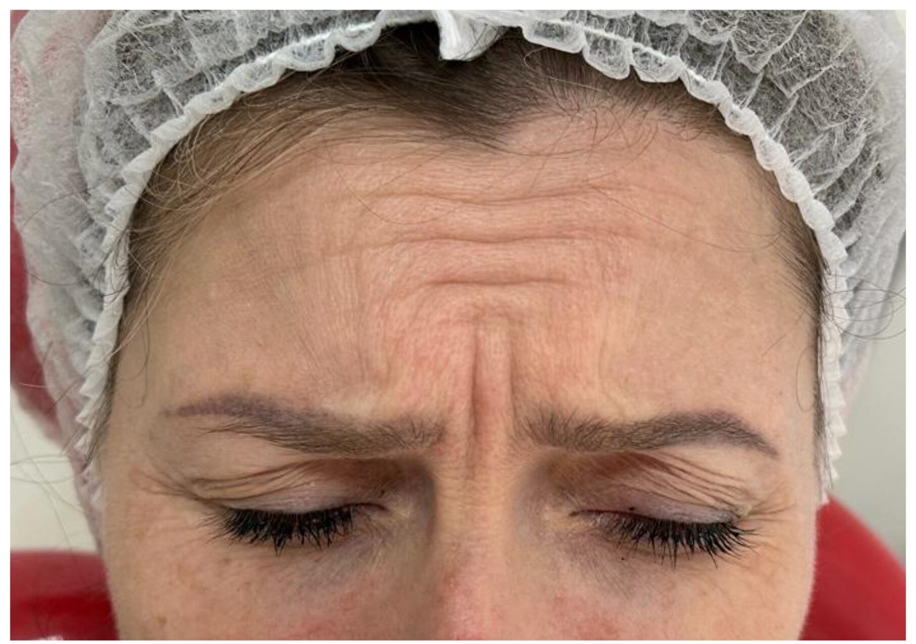 2JPG Before - After